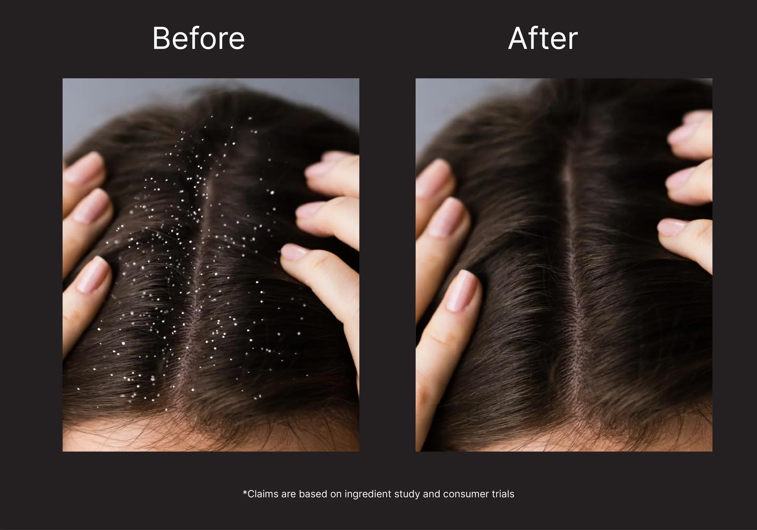 BARE ANATOMY - Anti Dandruff Mask 250gm - Image 4
