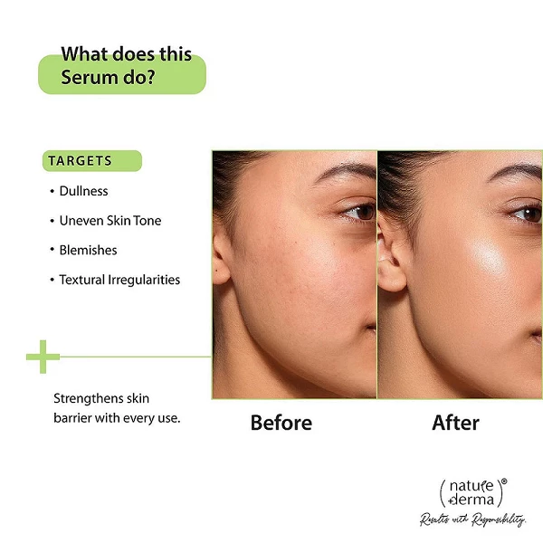 Nature Derma 10% Vitamin C Serum, 30ml - Image 2