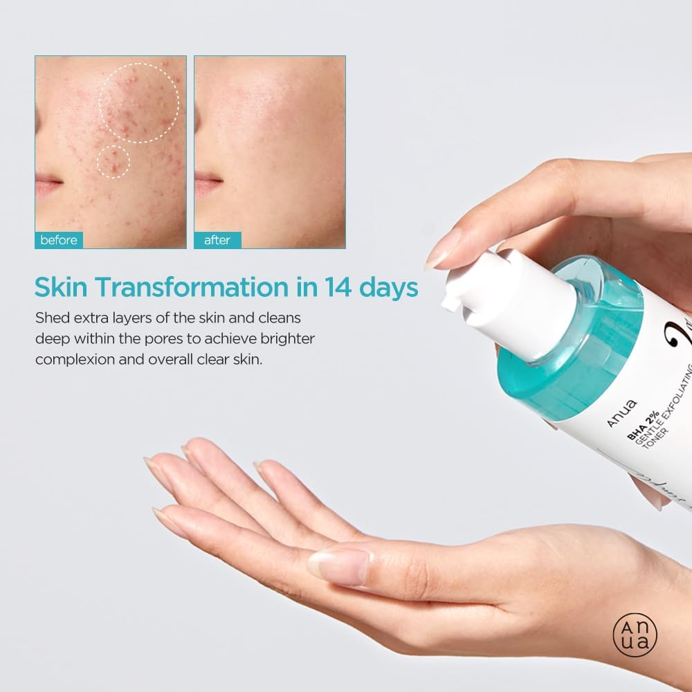 Anua BHA 2% Gentle Exfoliating Toner 150ml EXP 2026/08/26 - Image 4