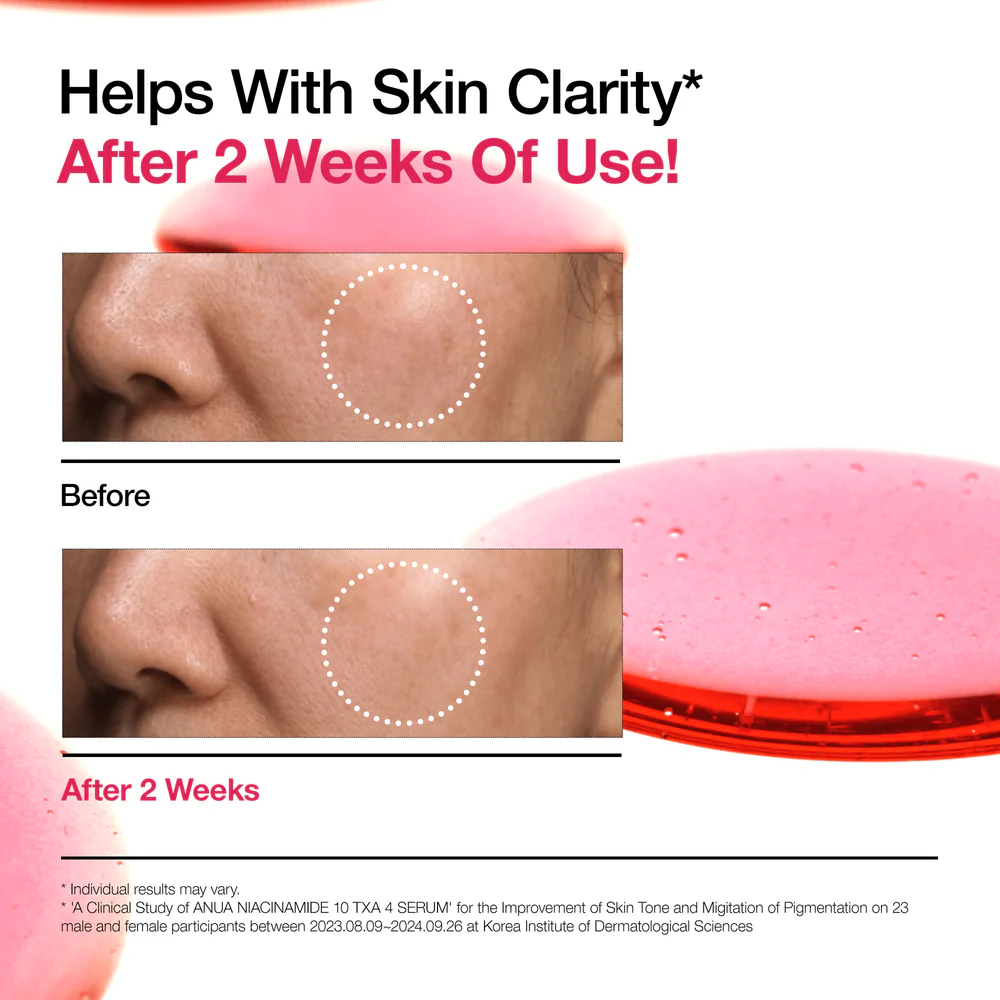 Anua Niacinamide 10% + Txa 4% Dark Spot Serum-30ml - Image 9
