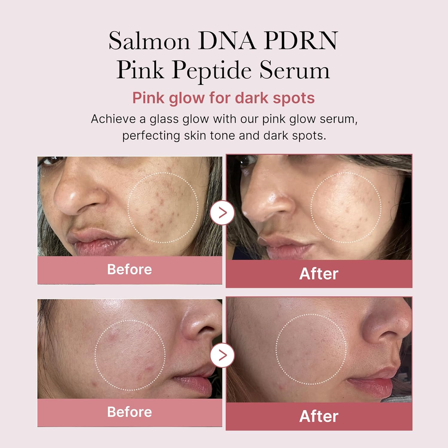 medicube Salmon DNA PDRN Pink Peptide Serum, Pink glow serum, Peptide, Niacinamide, Uneven Skin Tone,30ml - Image 2