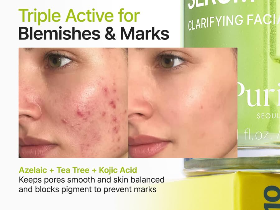 PURITO Azelaic Acid 10% + Kojic Acid Serum, 30mL - Image 2