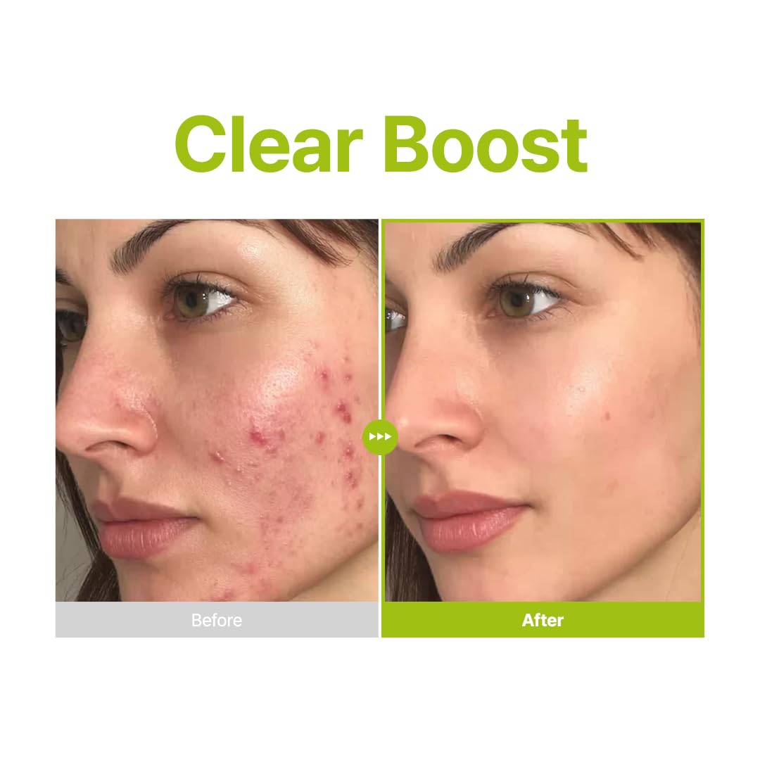 PURITO Azelaic Acid 10% + Kojic Acid Serum, 30mL - Image 5
