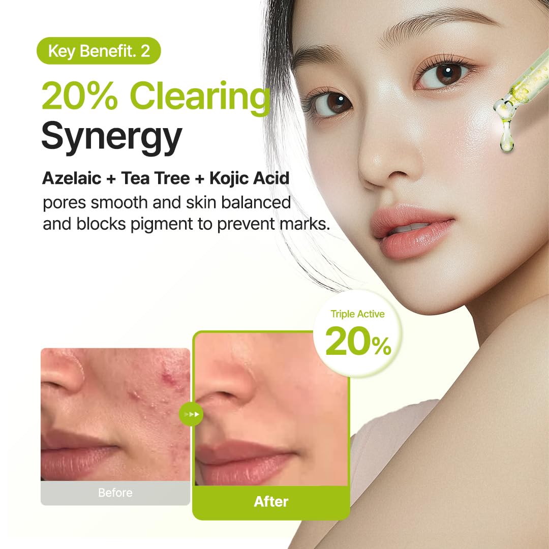 PURITO Azelaic Acid 10% + Kojic Acid Serum, 30mL - Image 6